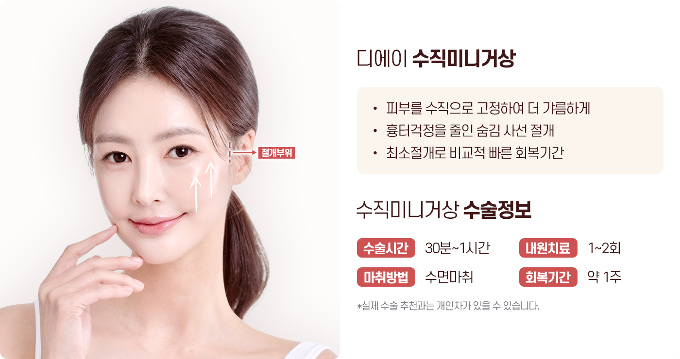 디에이 수직 미니거상