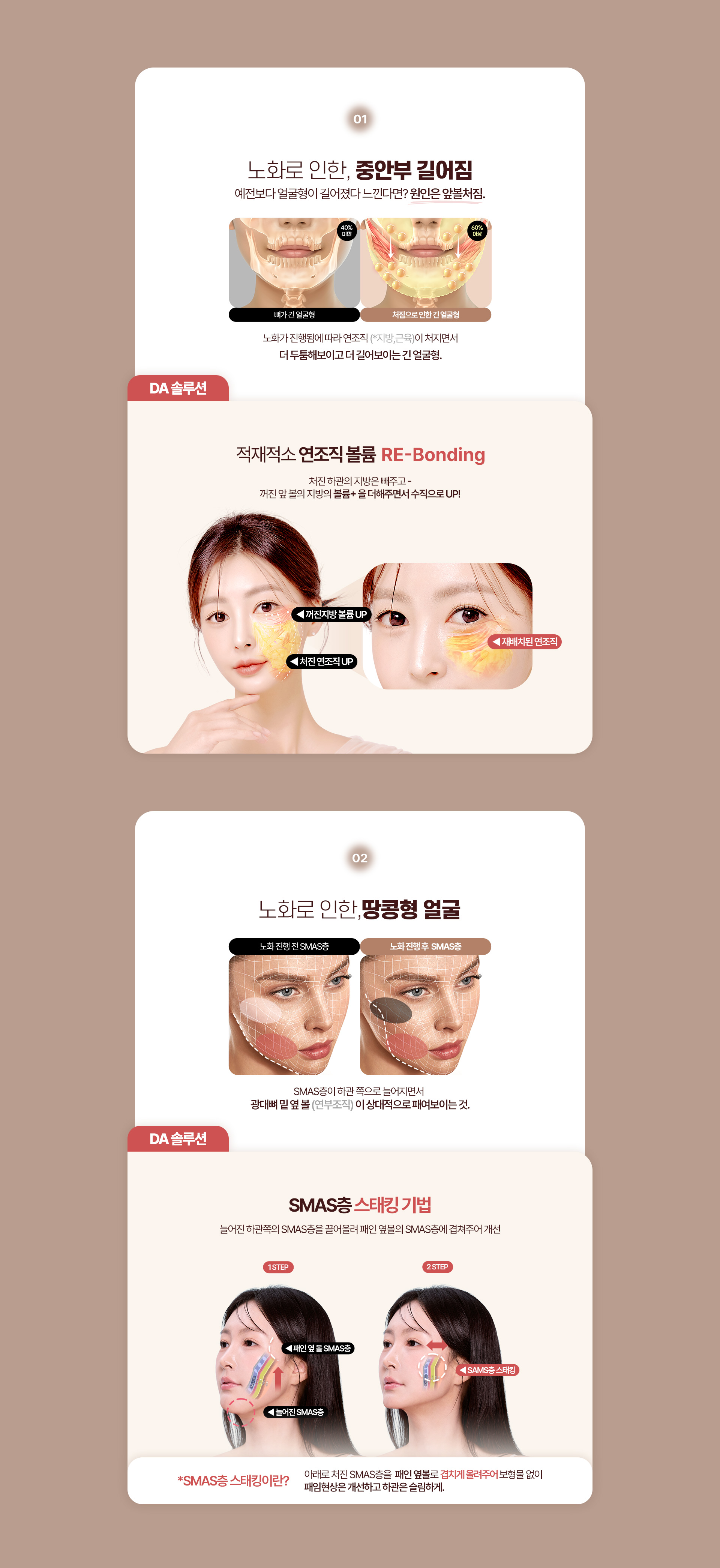 디에이 수직 미니거상