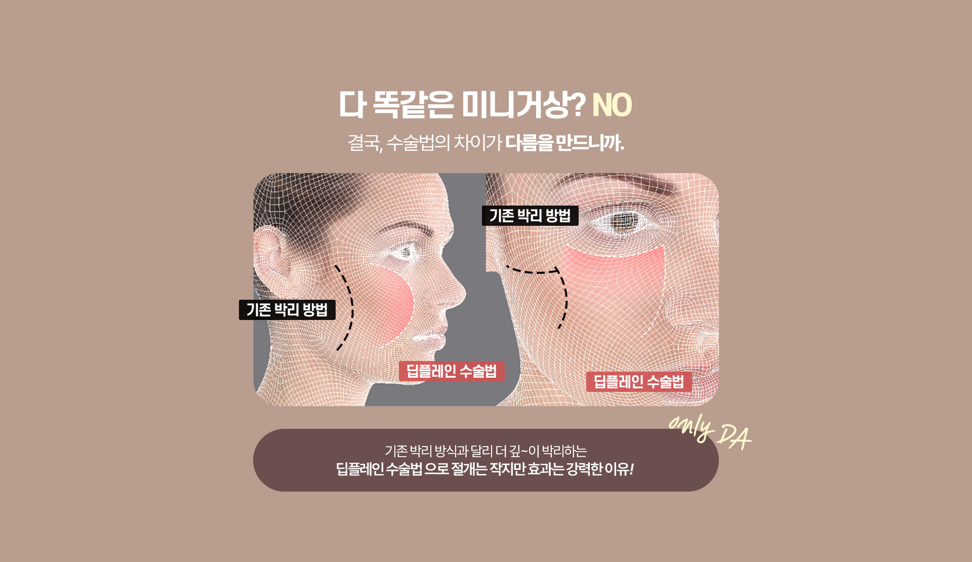 디에이 수직 미니거상