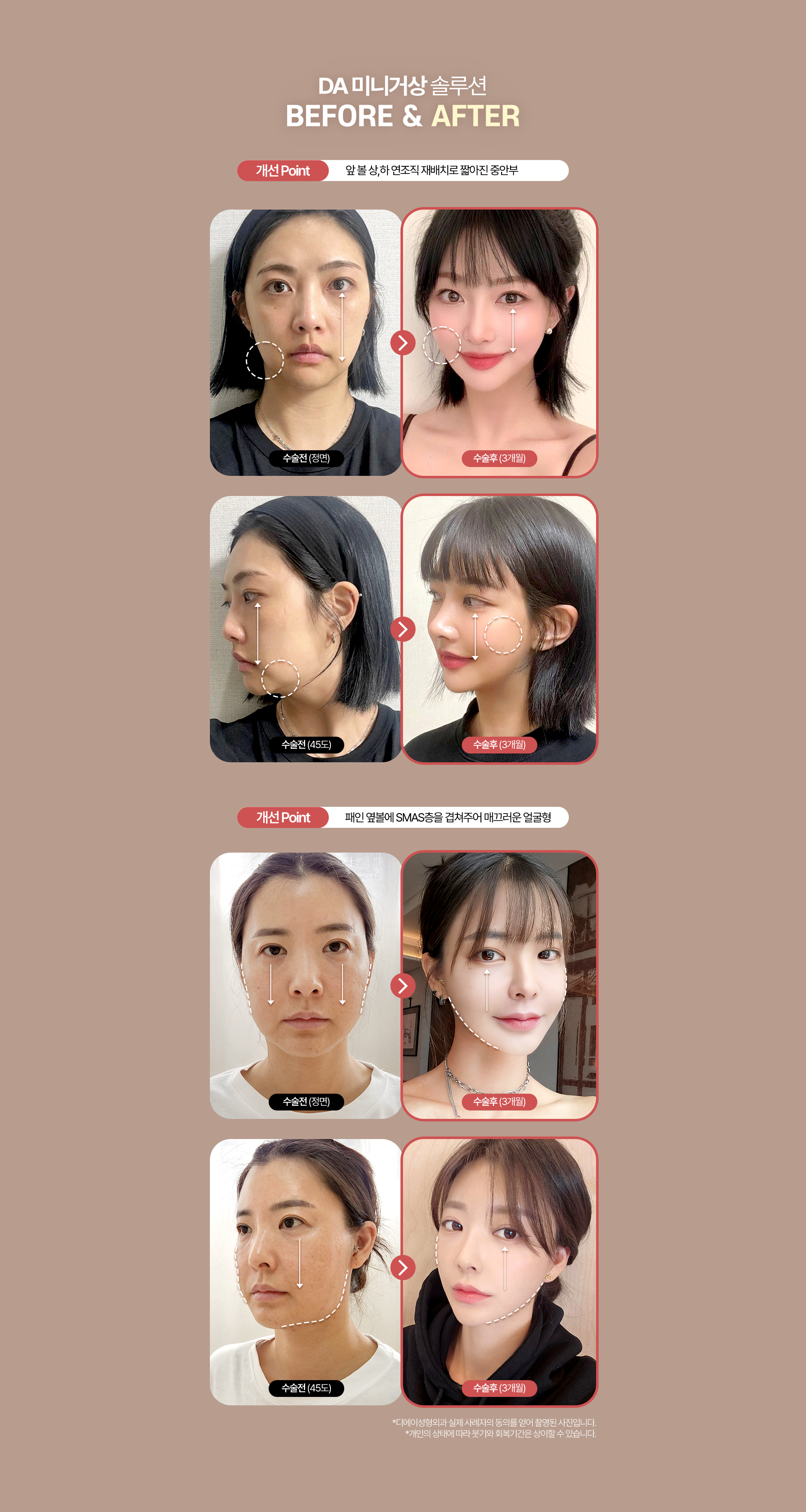 디에이 수직 미니거상