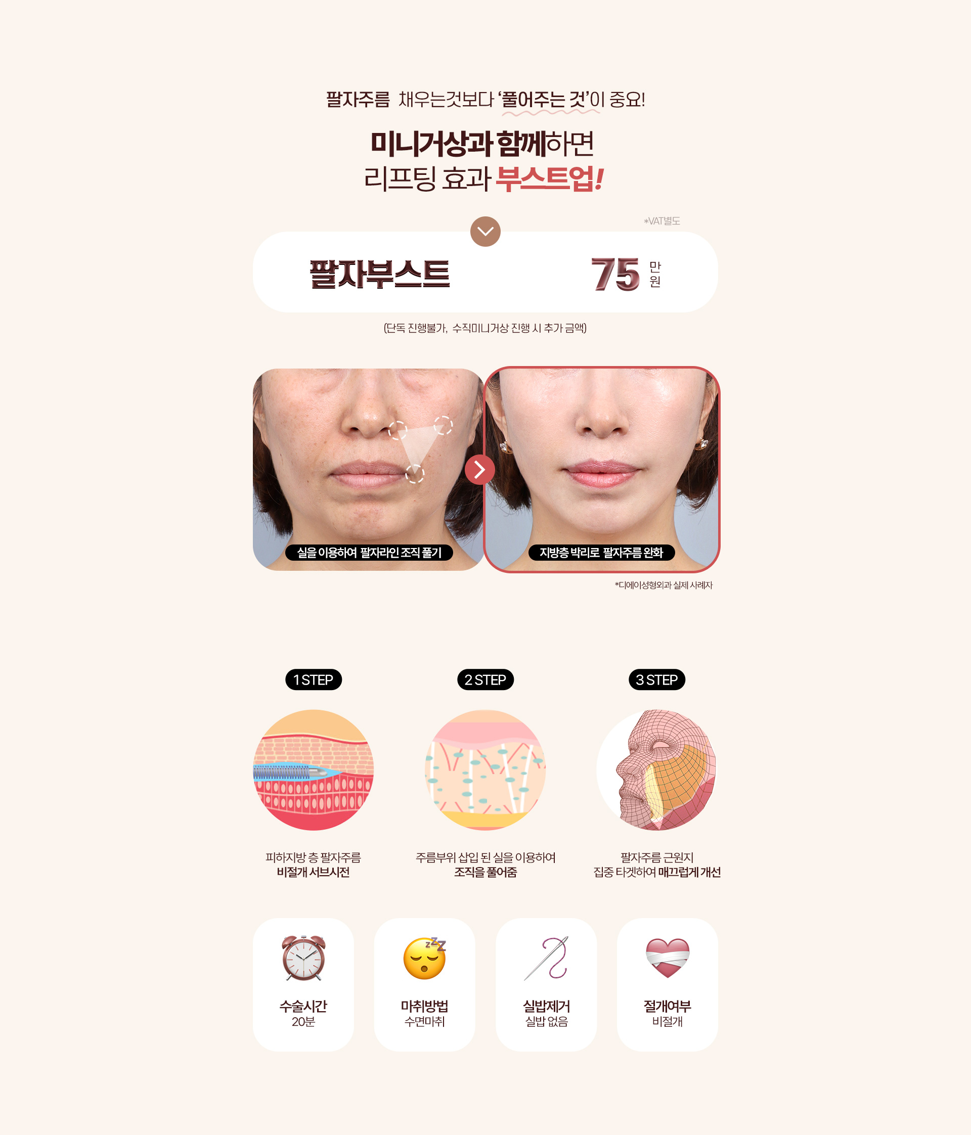 디에이 수직 미니거상