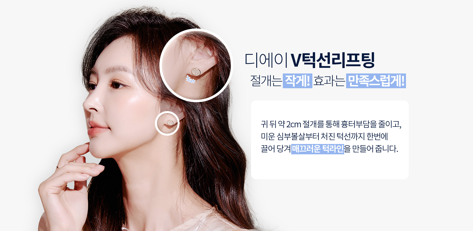 디에이 V턱선리프팅