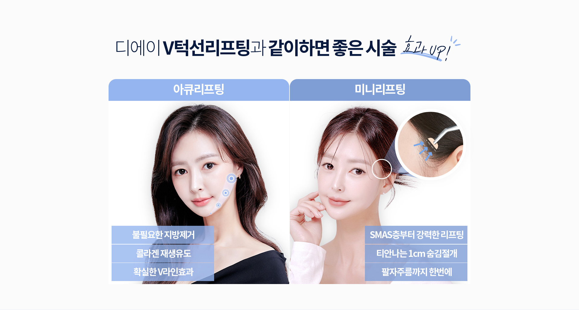 디에이 V턱선리프팅