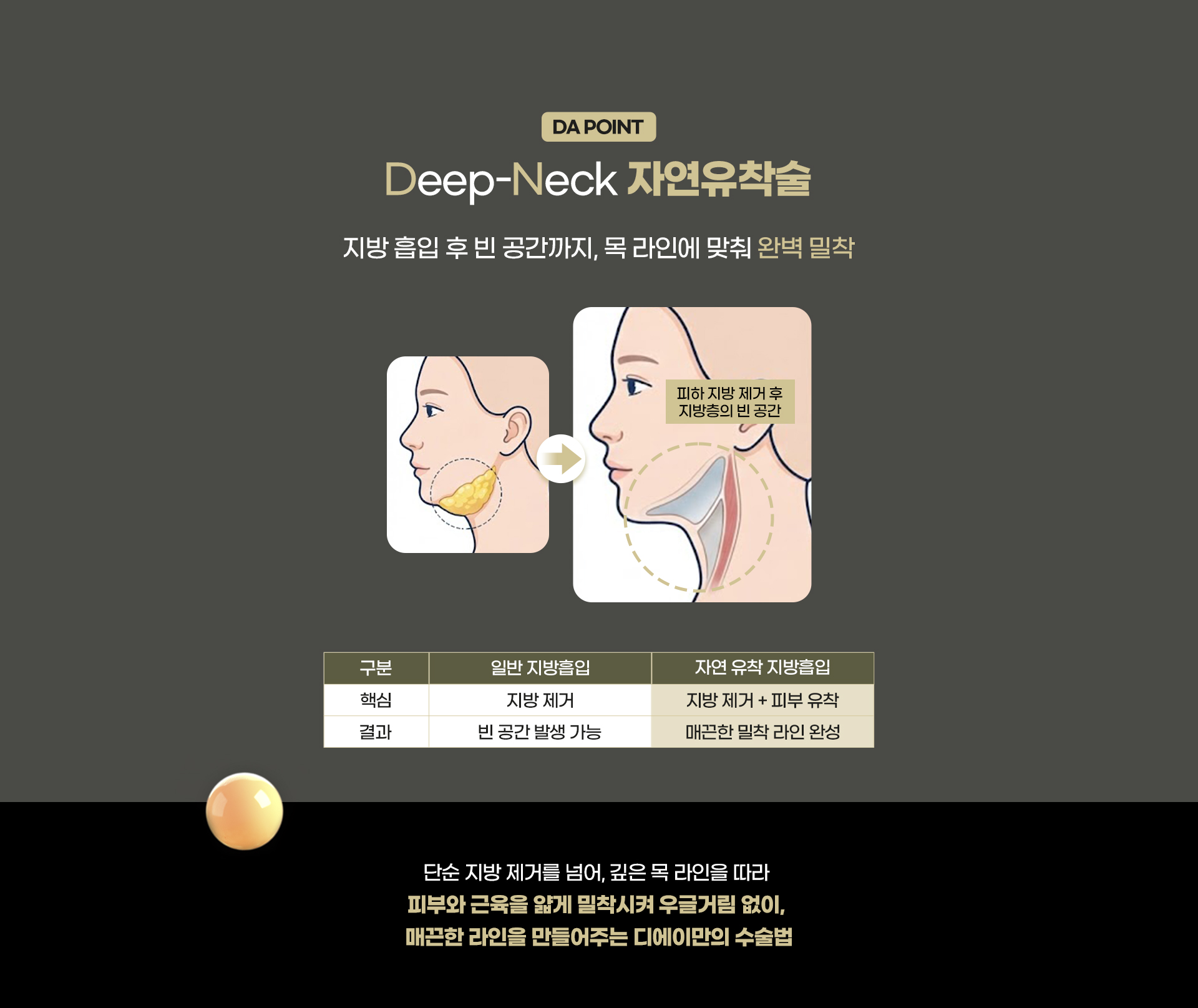 디에이 연조직 이중턱 근육묶기