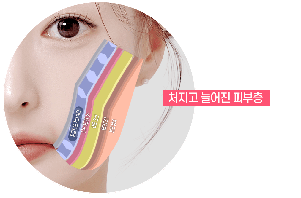 디에이 수직미니리프팅