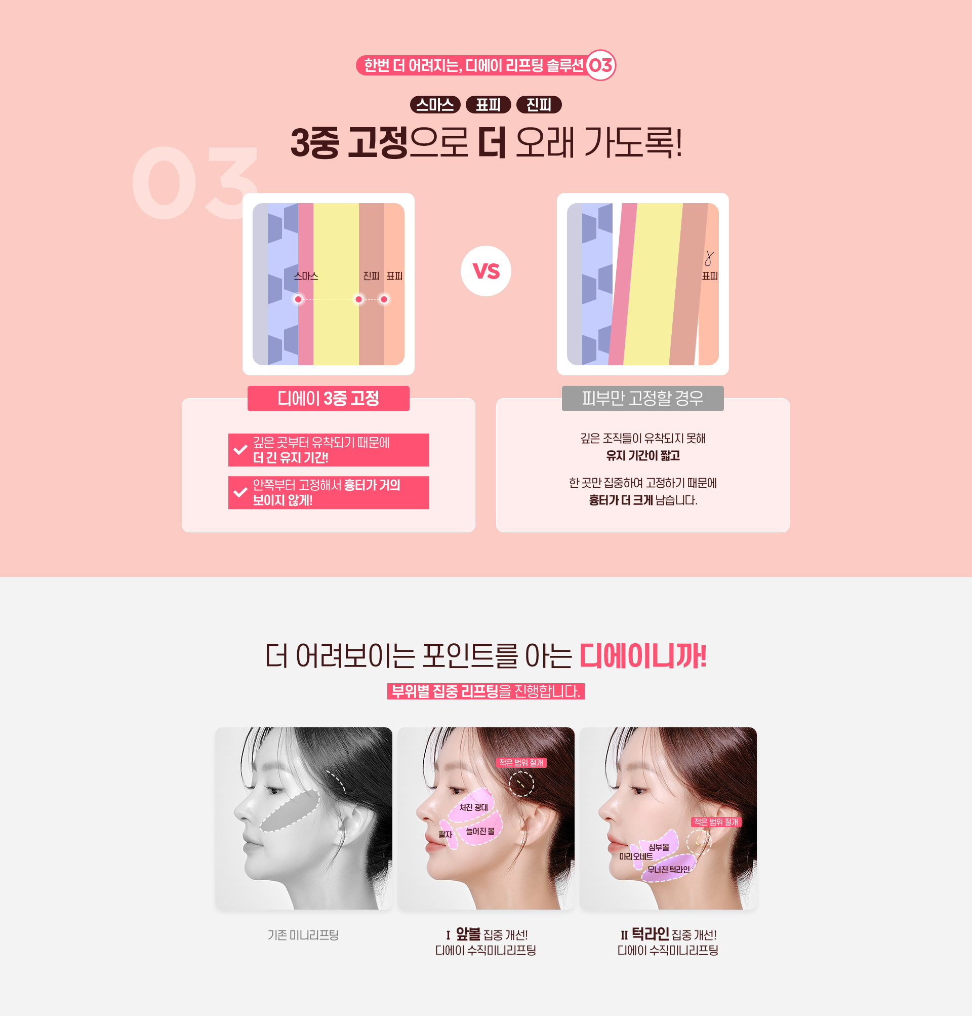 디에이 수직미니리프팅
