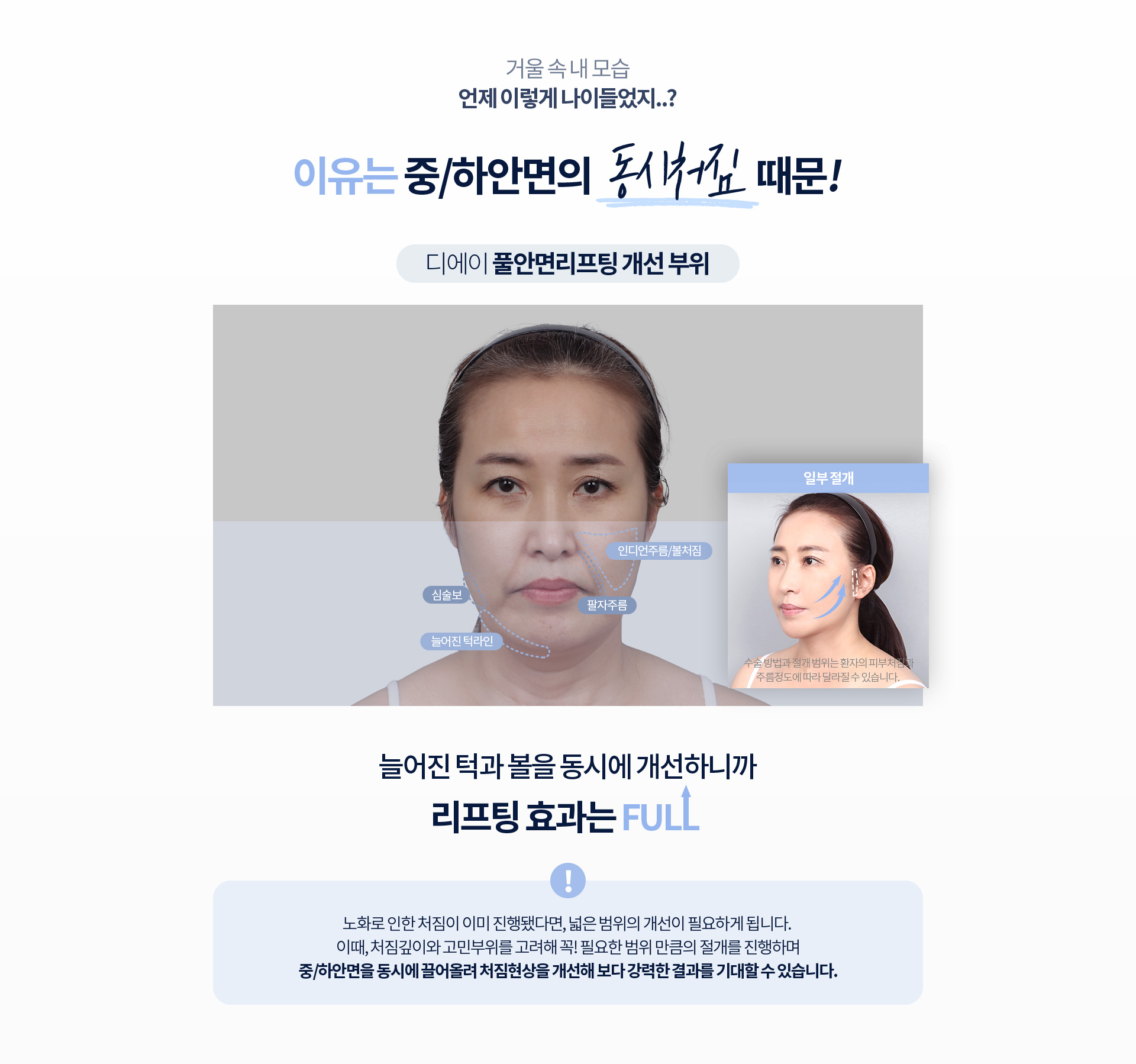 디에이 풀안면리프팅 개선 부위