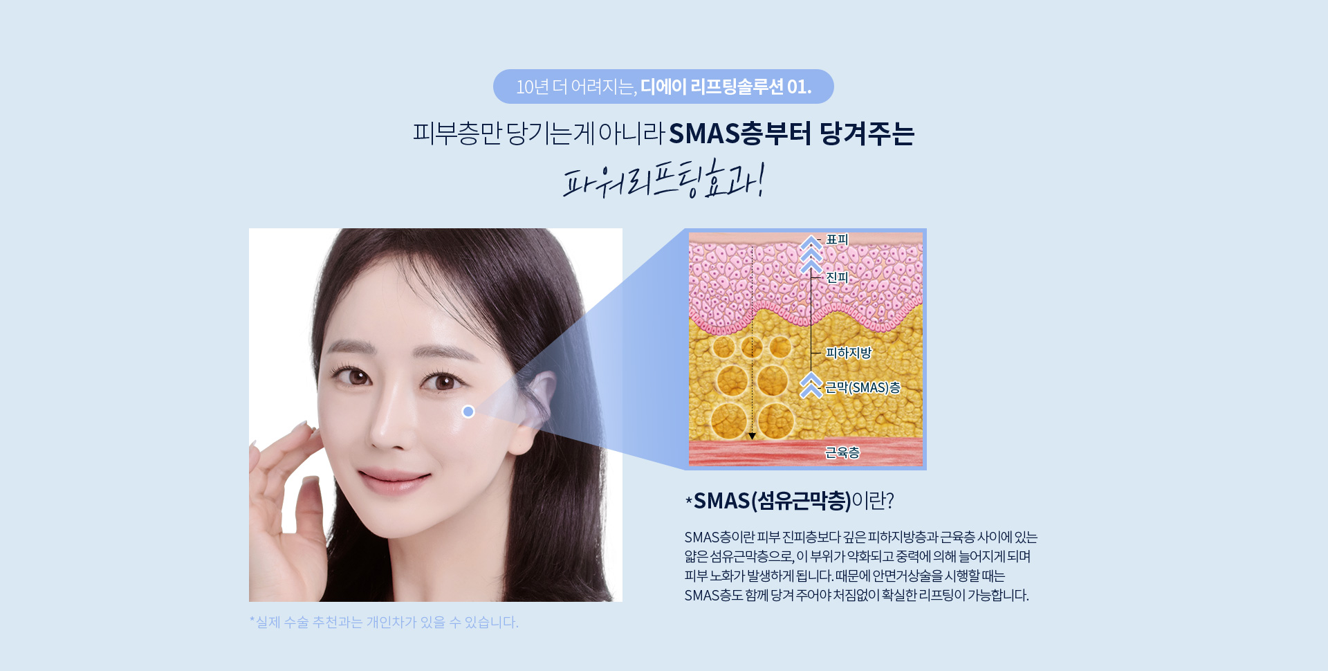 디에이 풀안면리프팅 솔루션 01