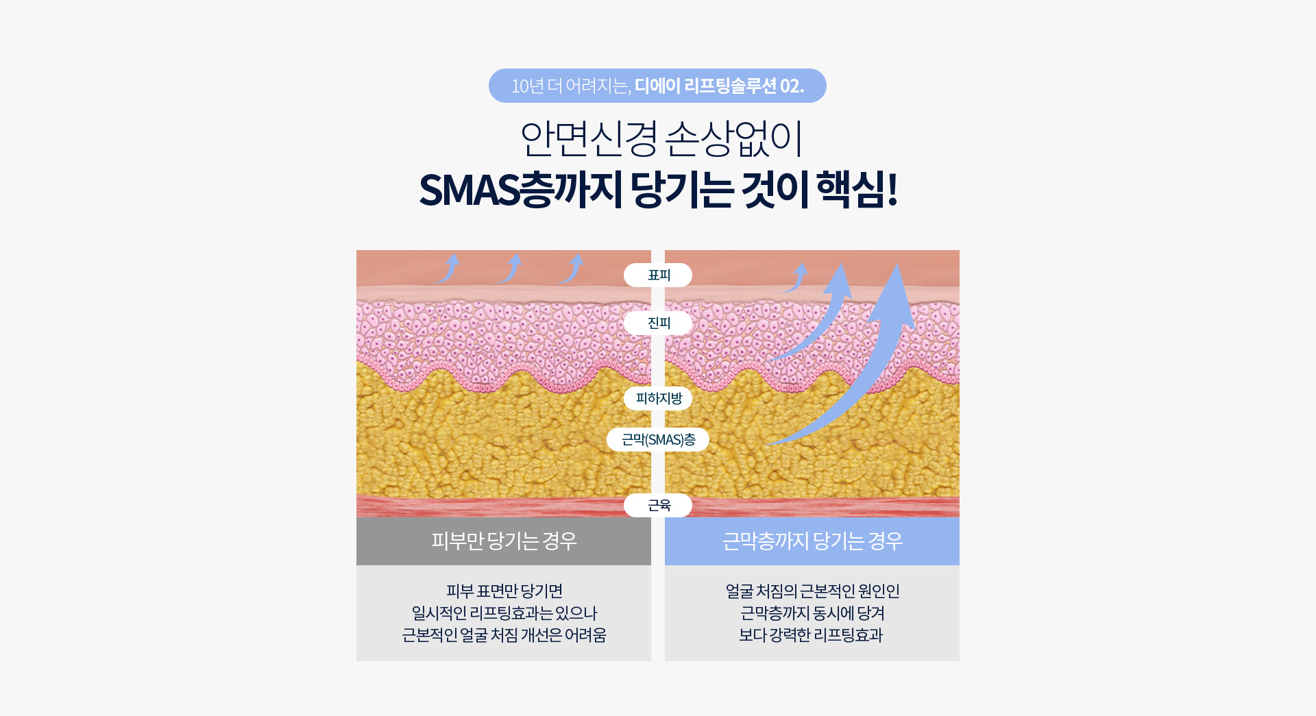 디에이 풀안면리프팅 솔루션 02