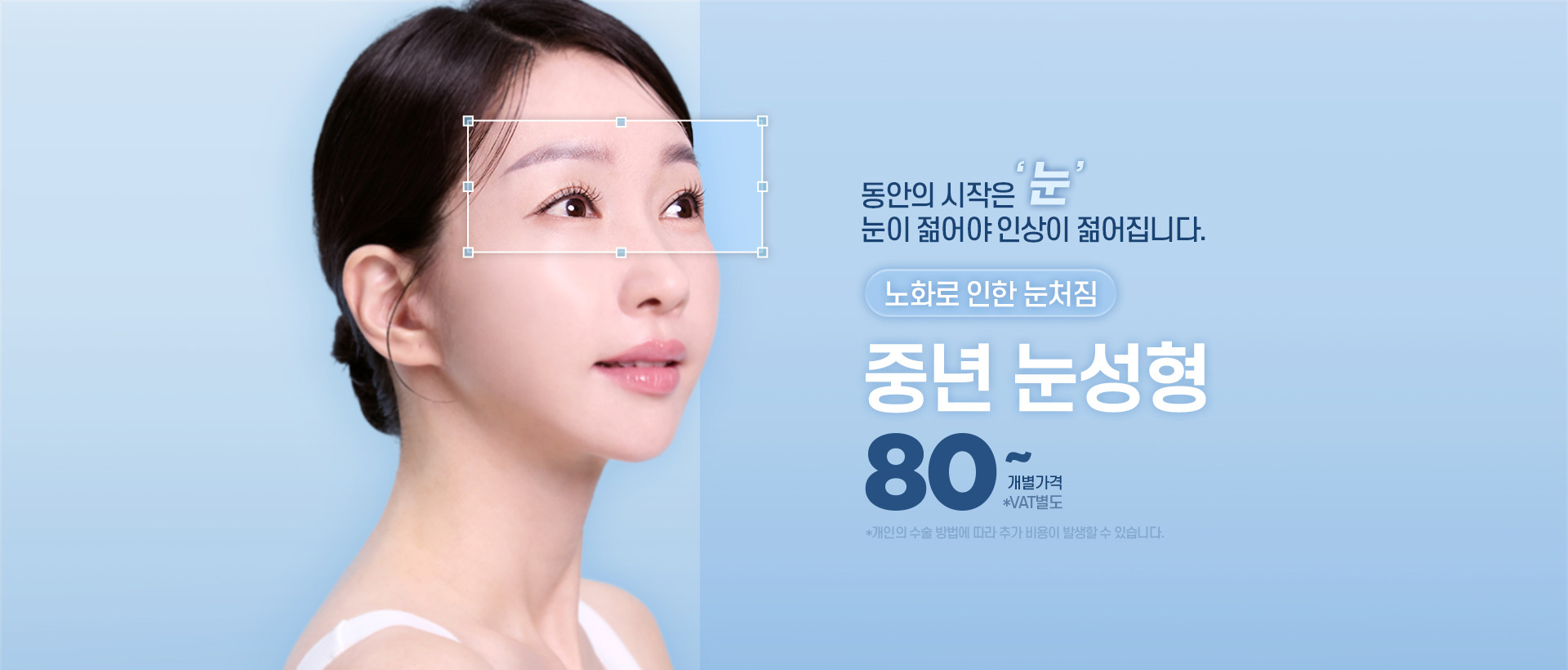 디에이 중년눈성형