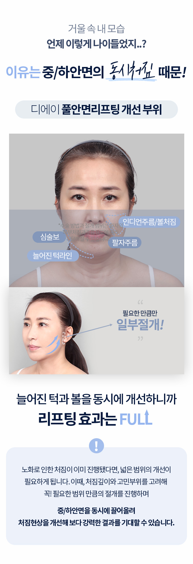 디에이 풀안면리프팅 개선 부위
