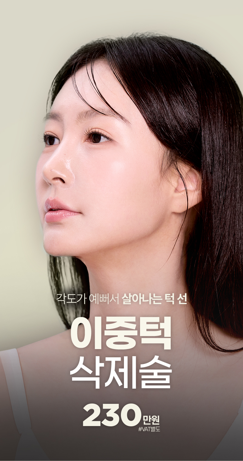 디에이 이중턱 삭제술