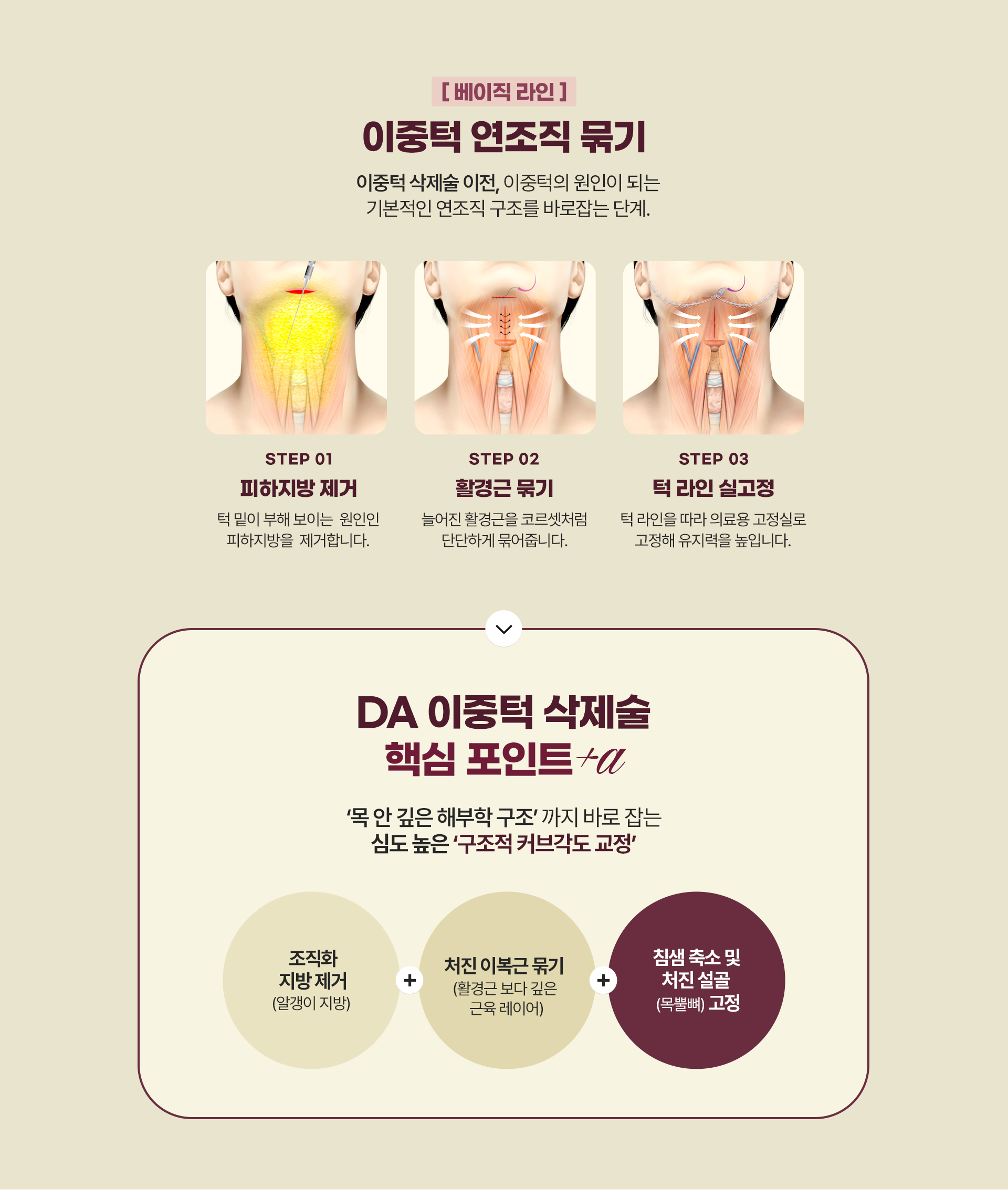 디에이 이중턱 삭제술