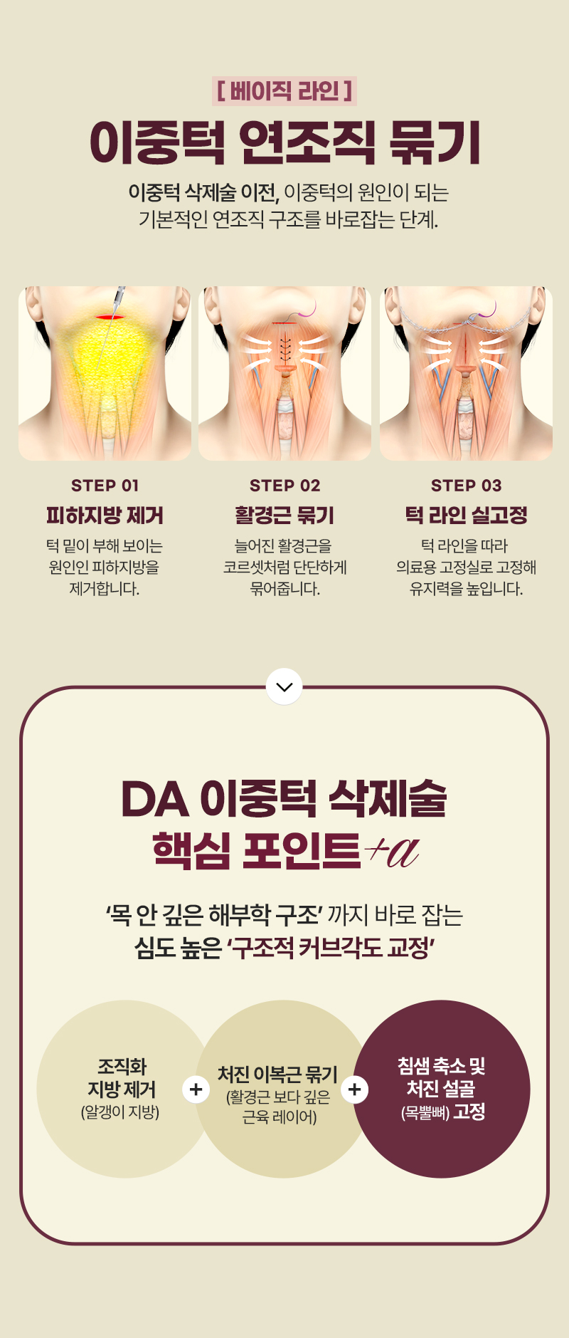 디에이 이중턱 삭제술