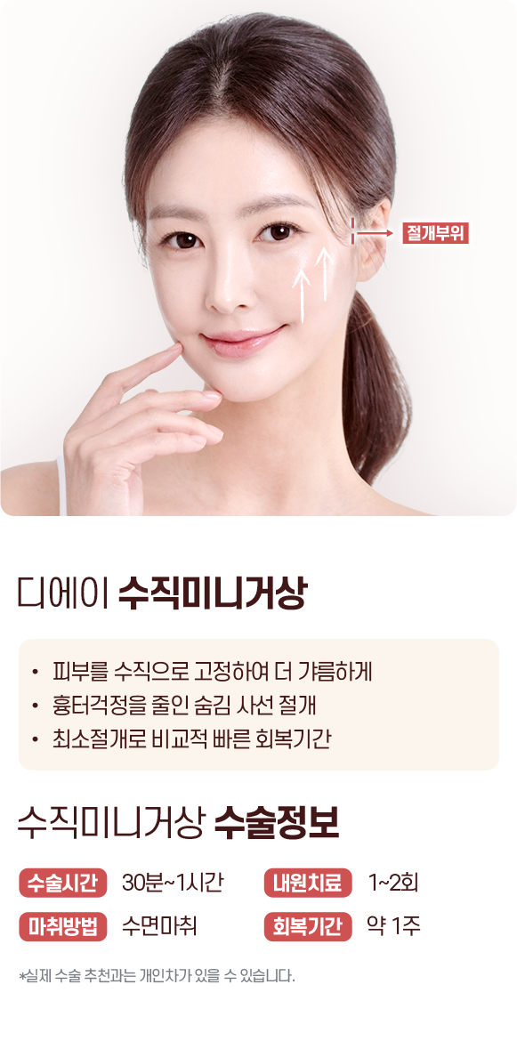 디에이 수직 미니거상