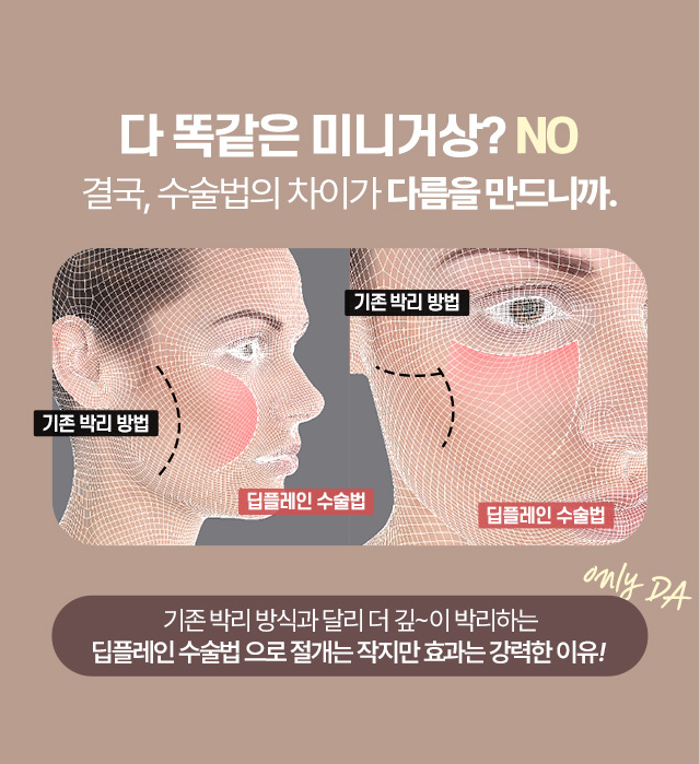 디에이 수직 미니거상