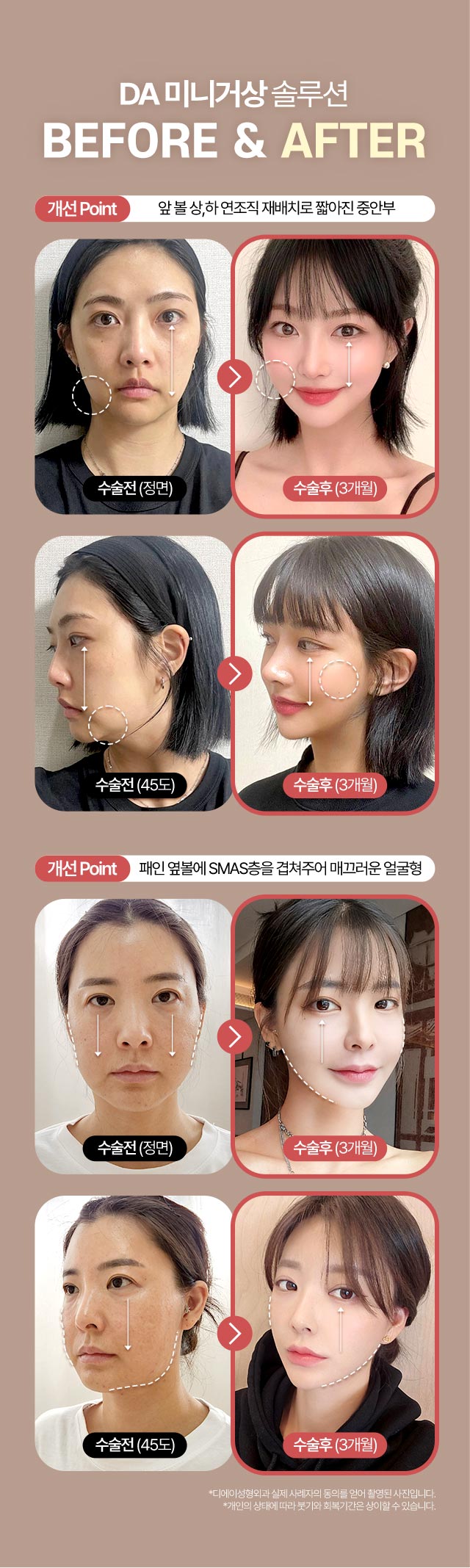 디에이 수직 미니거상