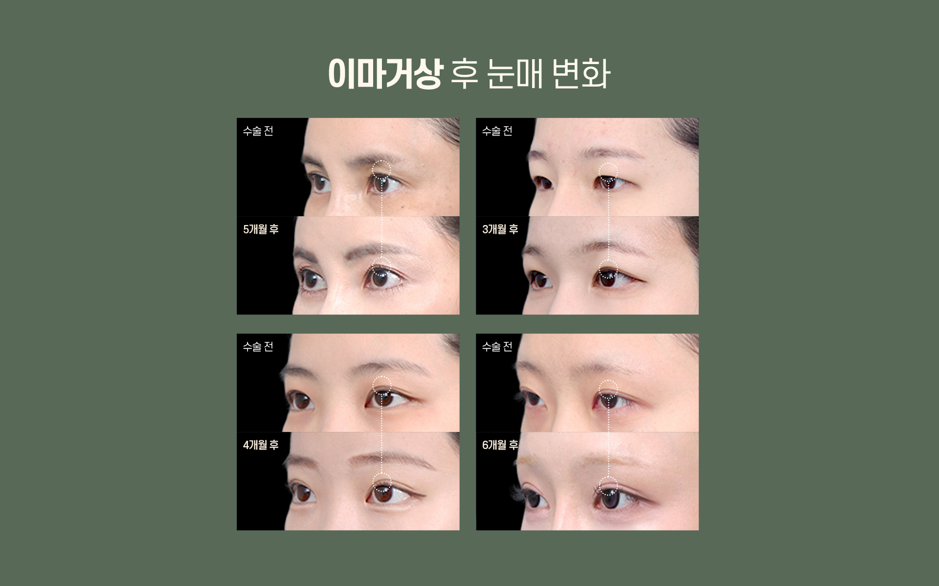 디에이 수직 이마거상