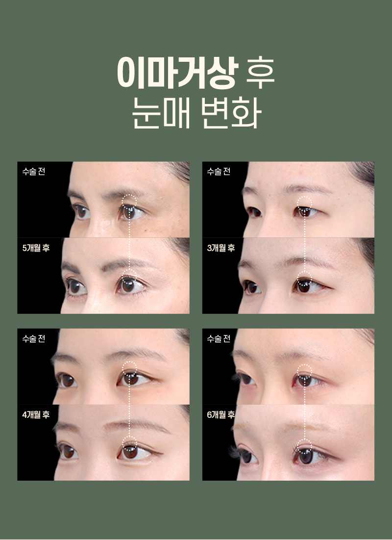 디에이 수직 이마거상