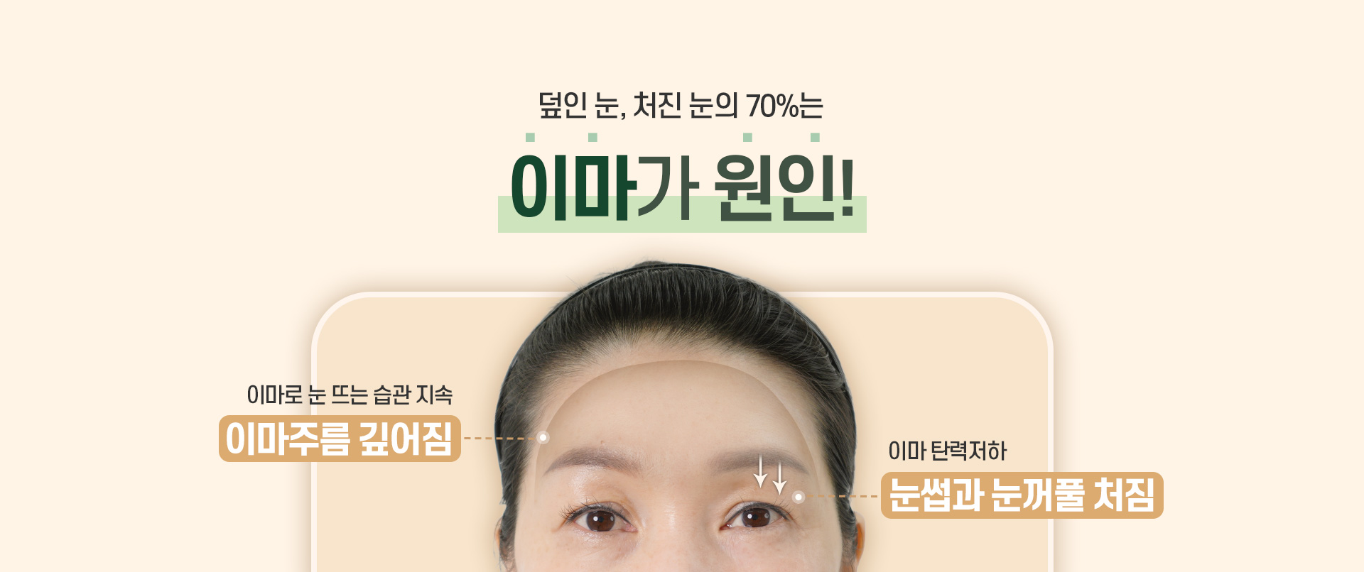 디에이 수직 이마거상