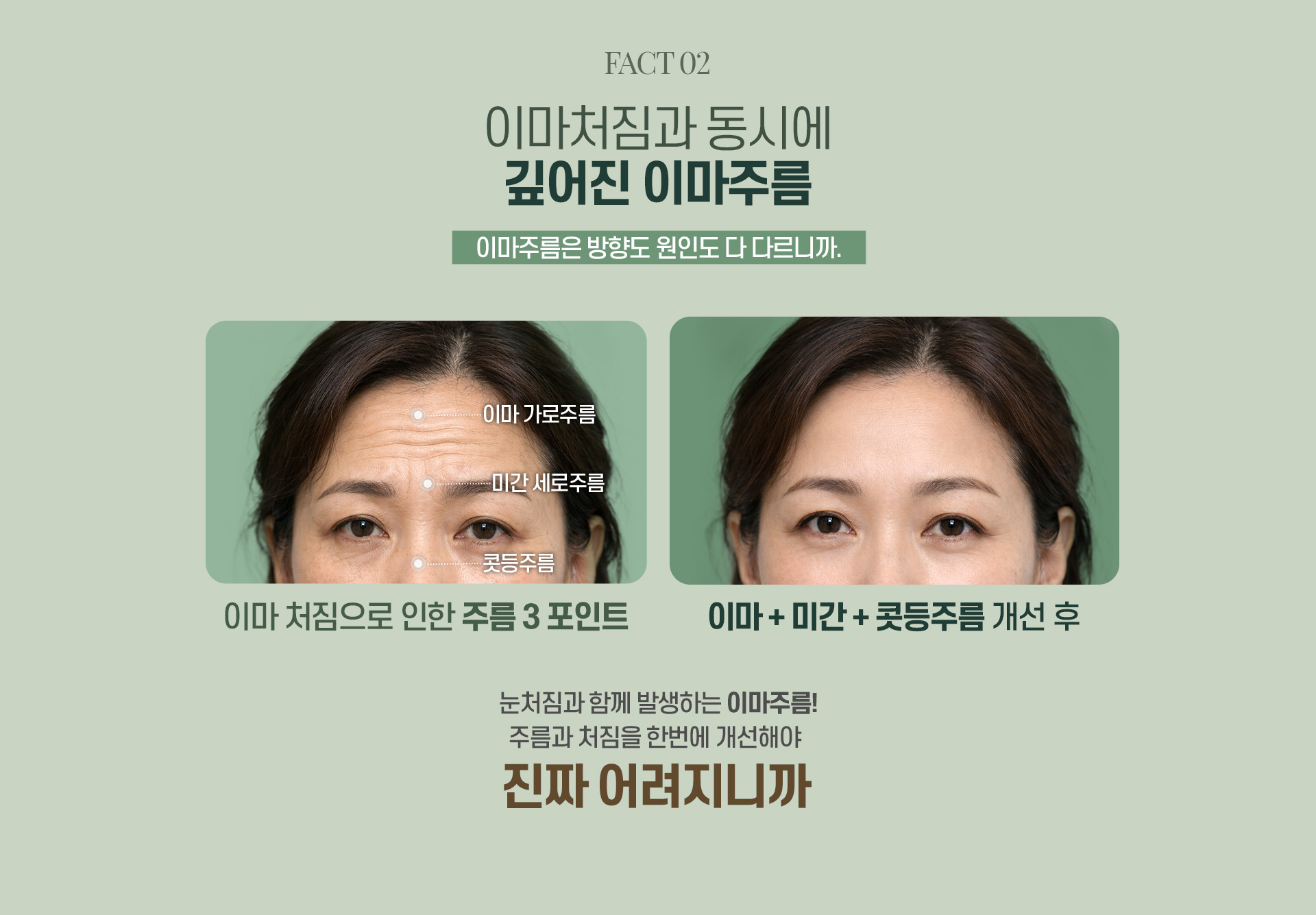 디에이 수직 이마거상