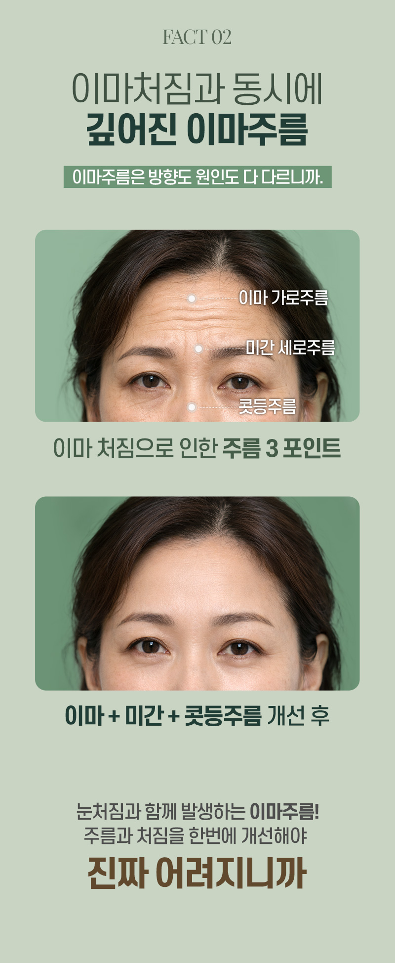 디에이 수직 이마거상