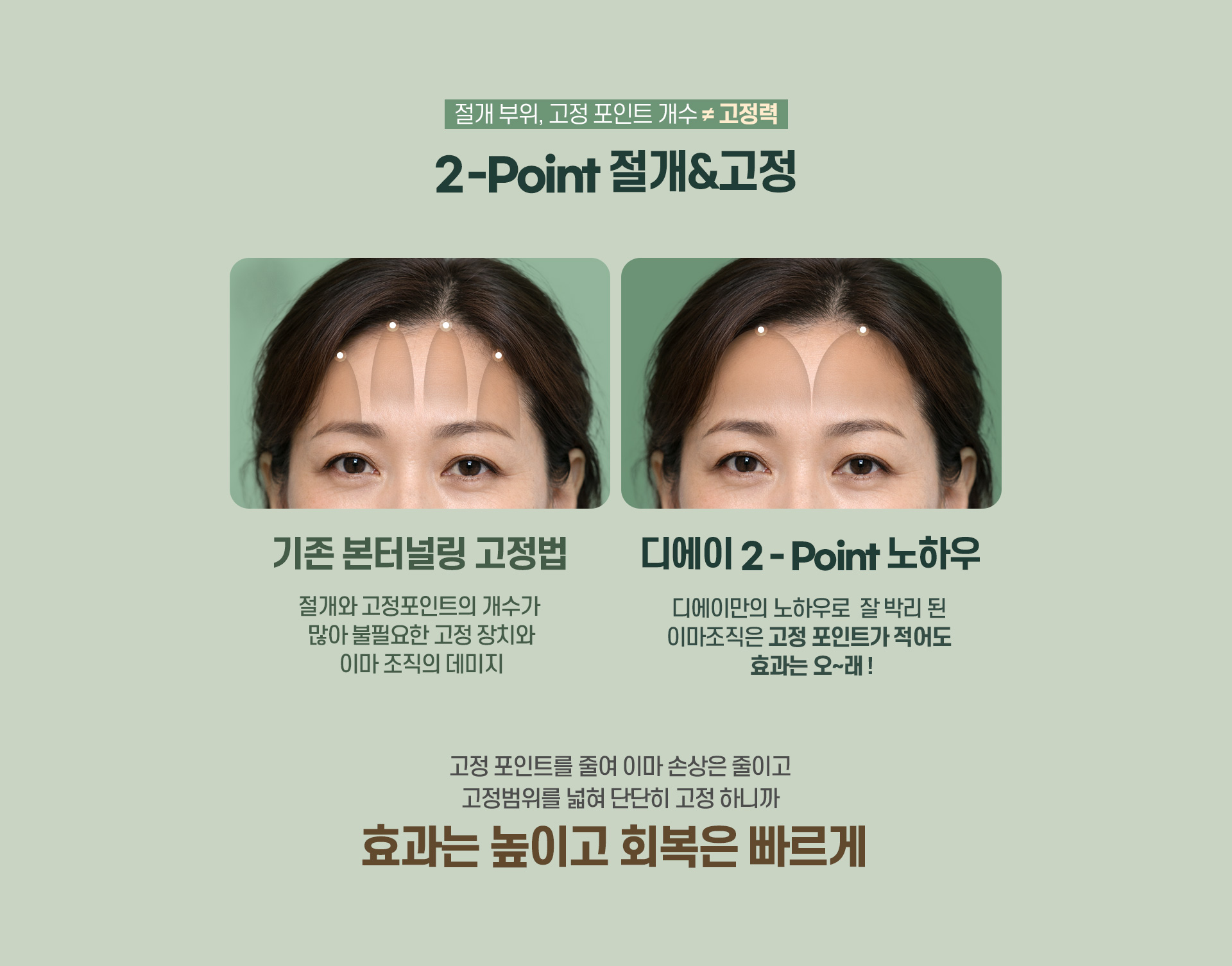 디에이 수직 이마거상