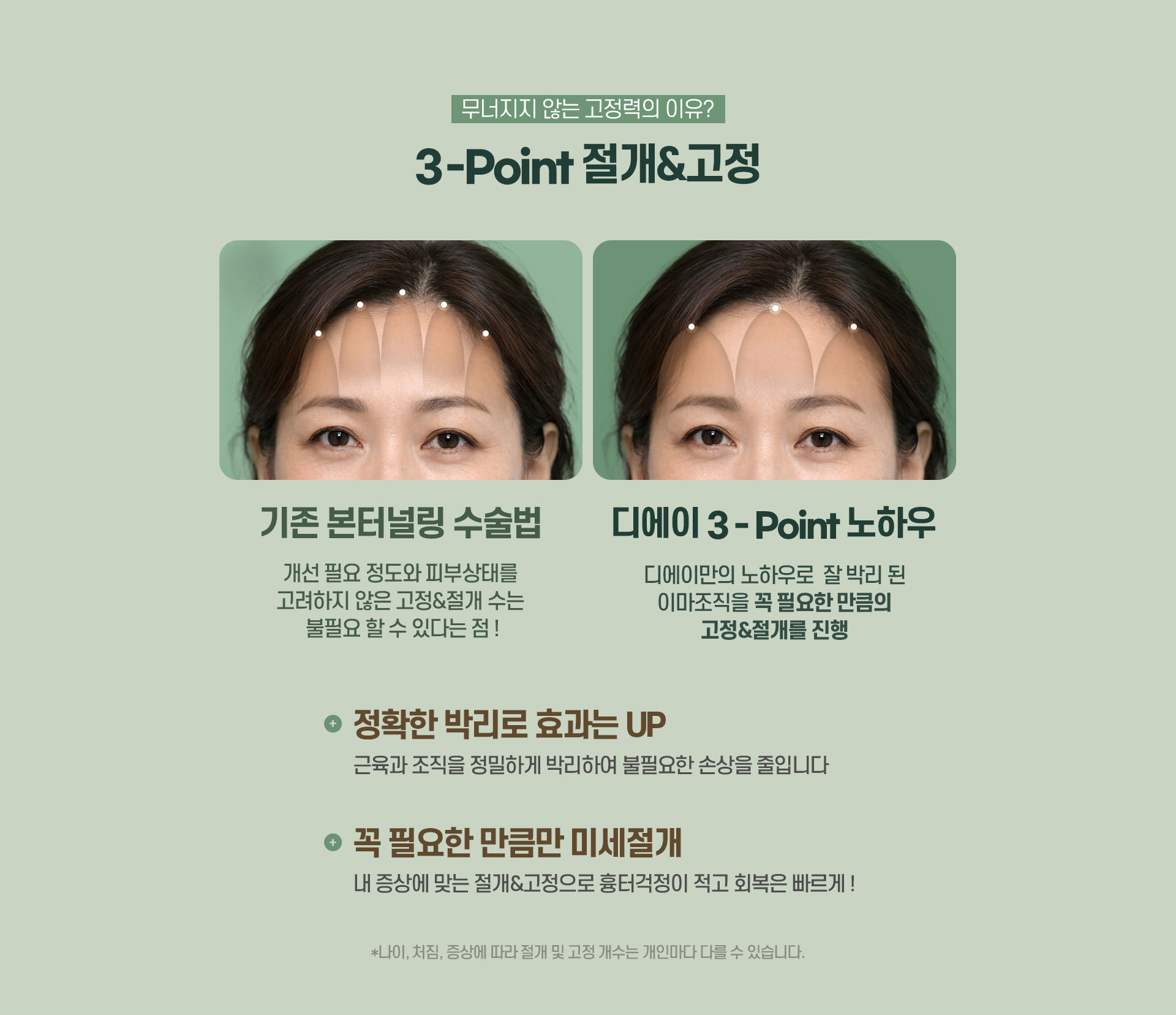 디에이 수직 이마거상