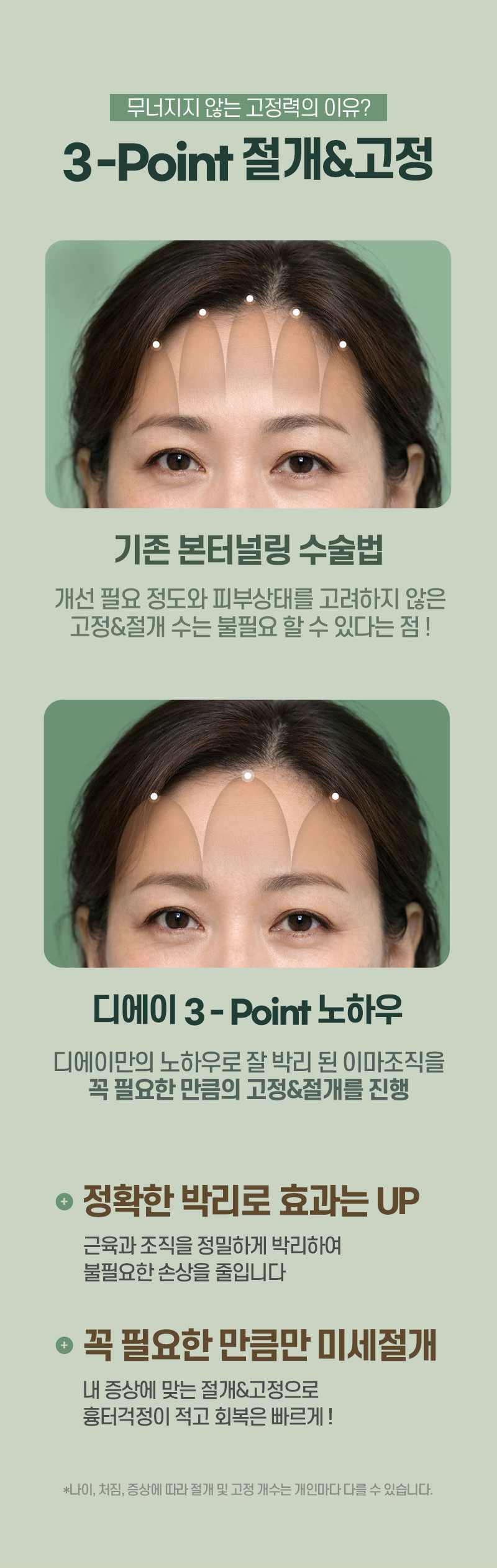 디에이 수직 이마거상