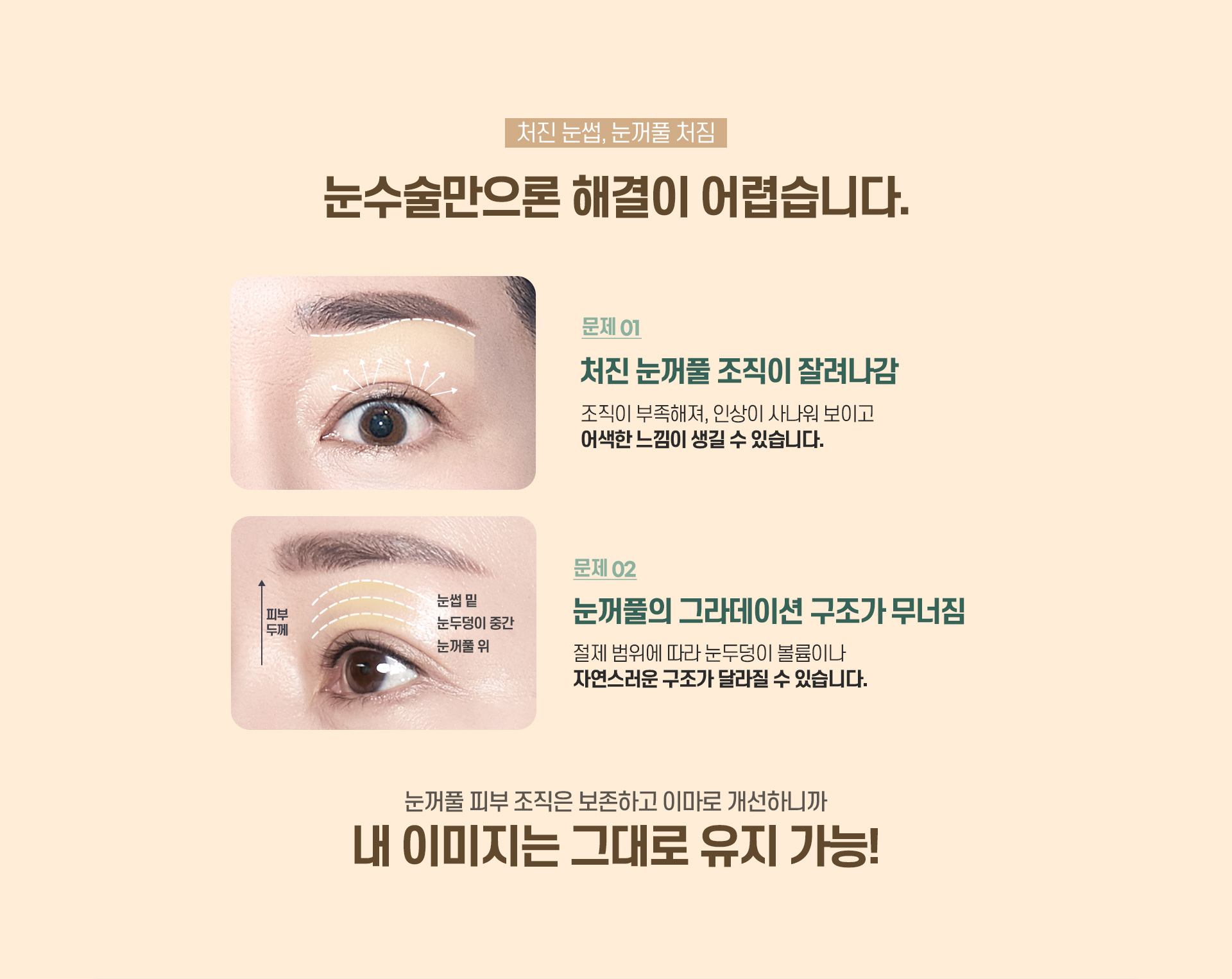 디에이 수직 이마거상