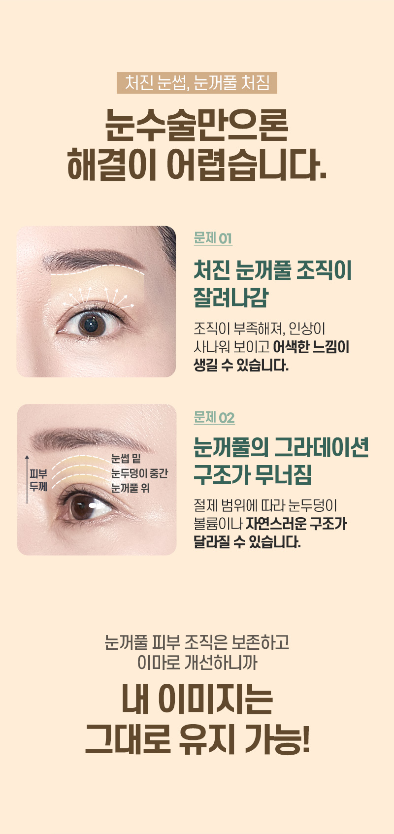 디에이 수직 이마거상