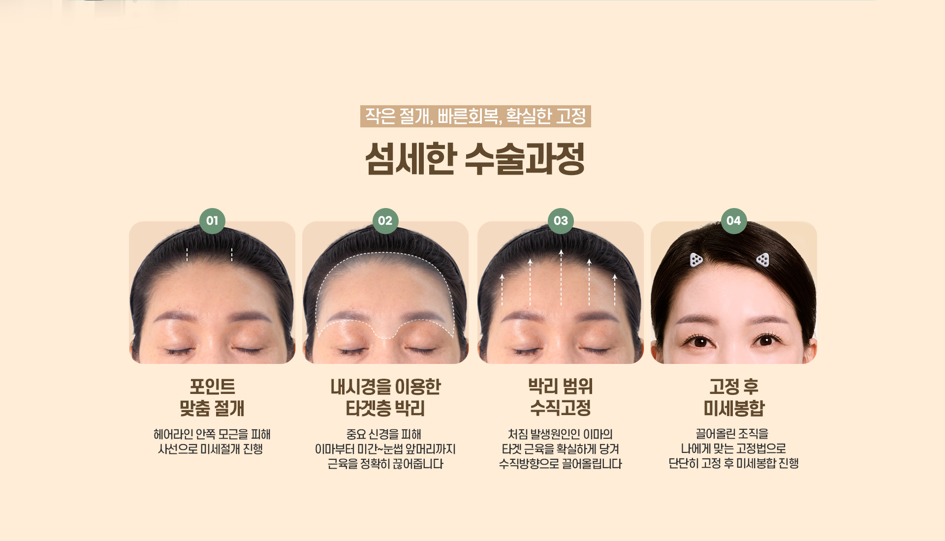 디에이 수직 이마거상