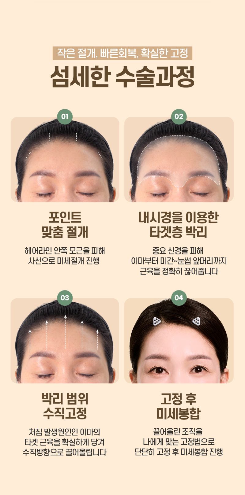 디에이 수직 이마거상