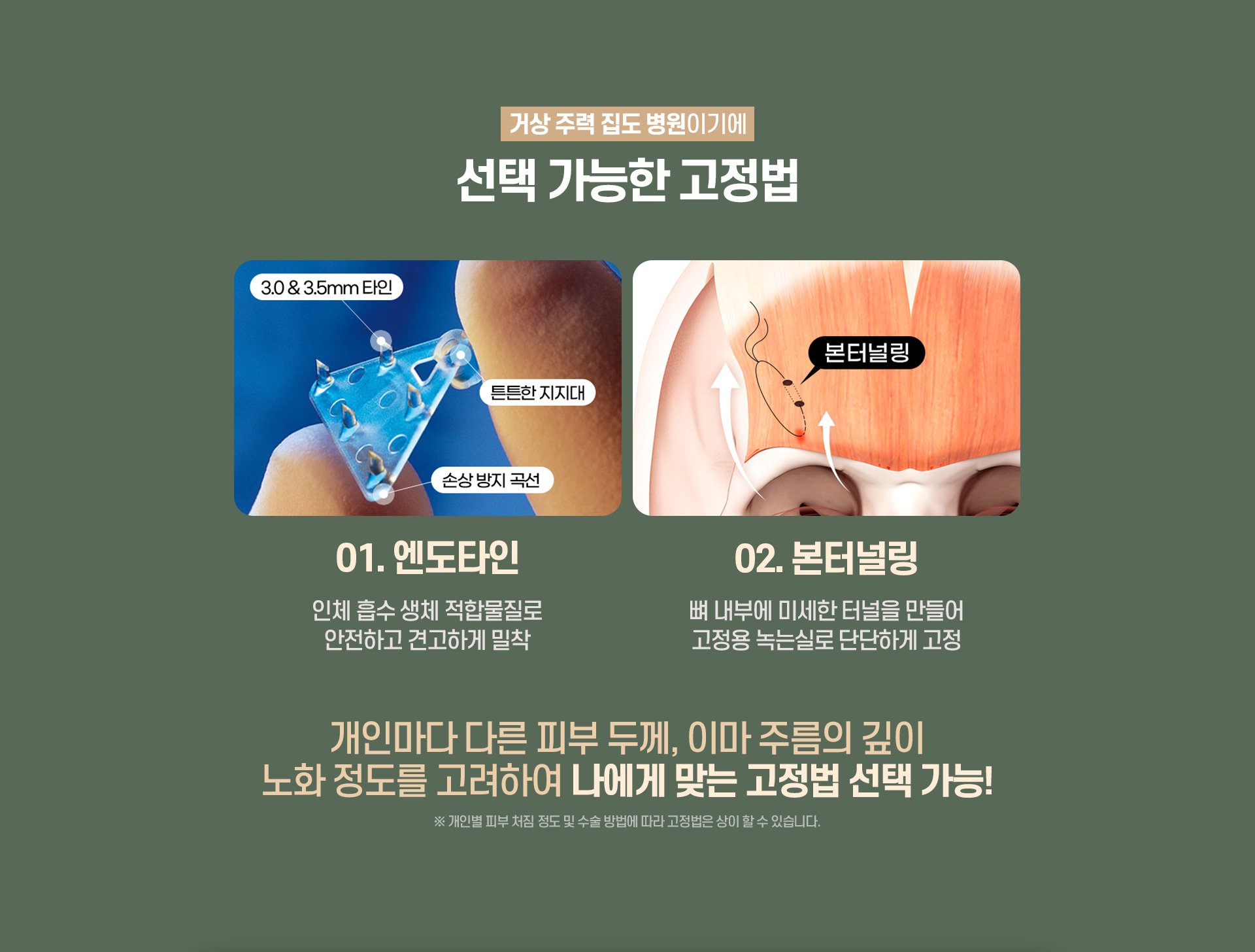 디에이 수직 이마거상