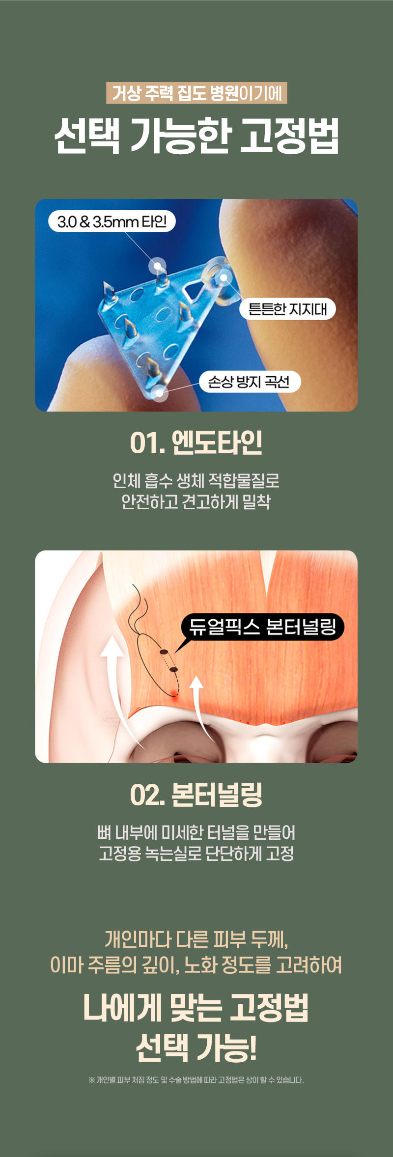 디에이 수직 이마거상