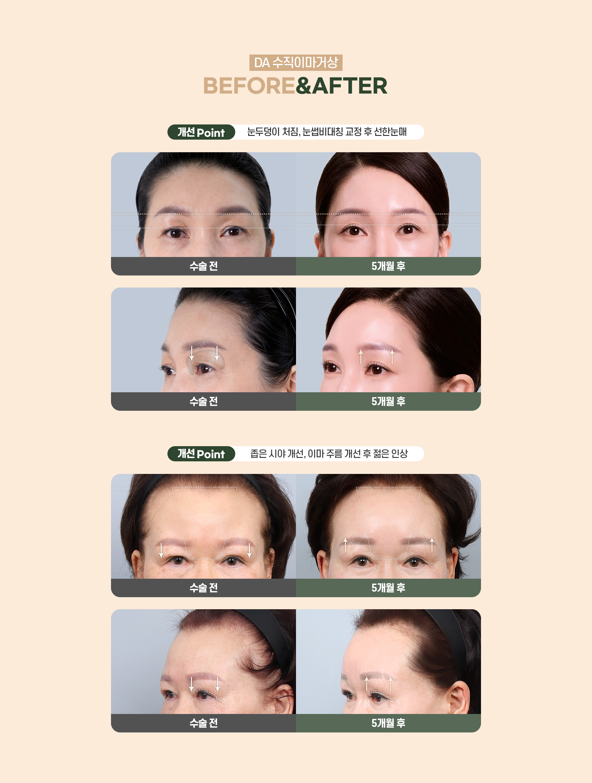 디에이 수직 이마거상