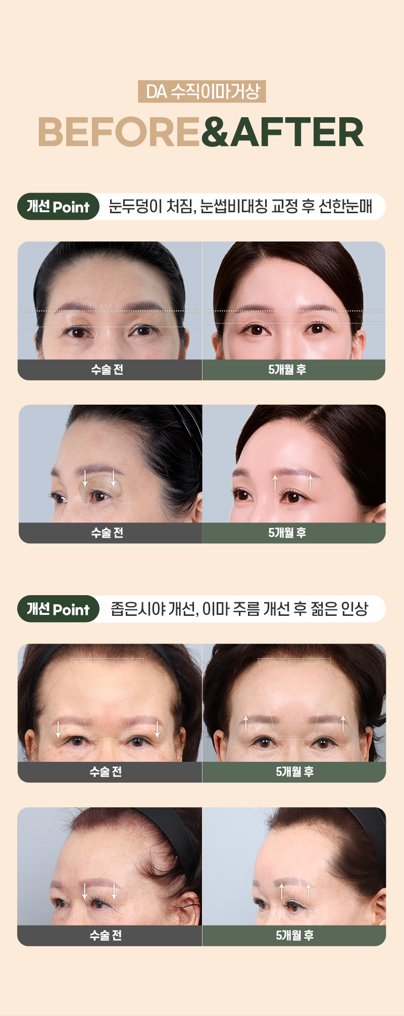 디에이 수직 이마거상