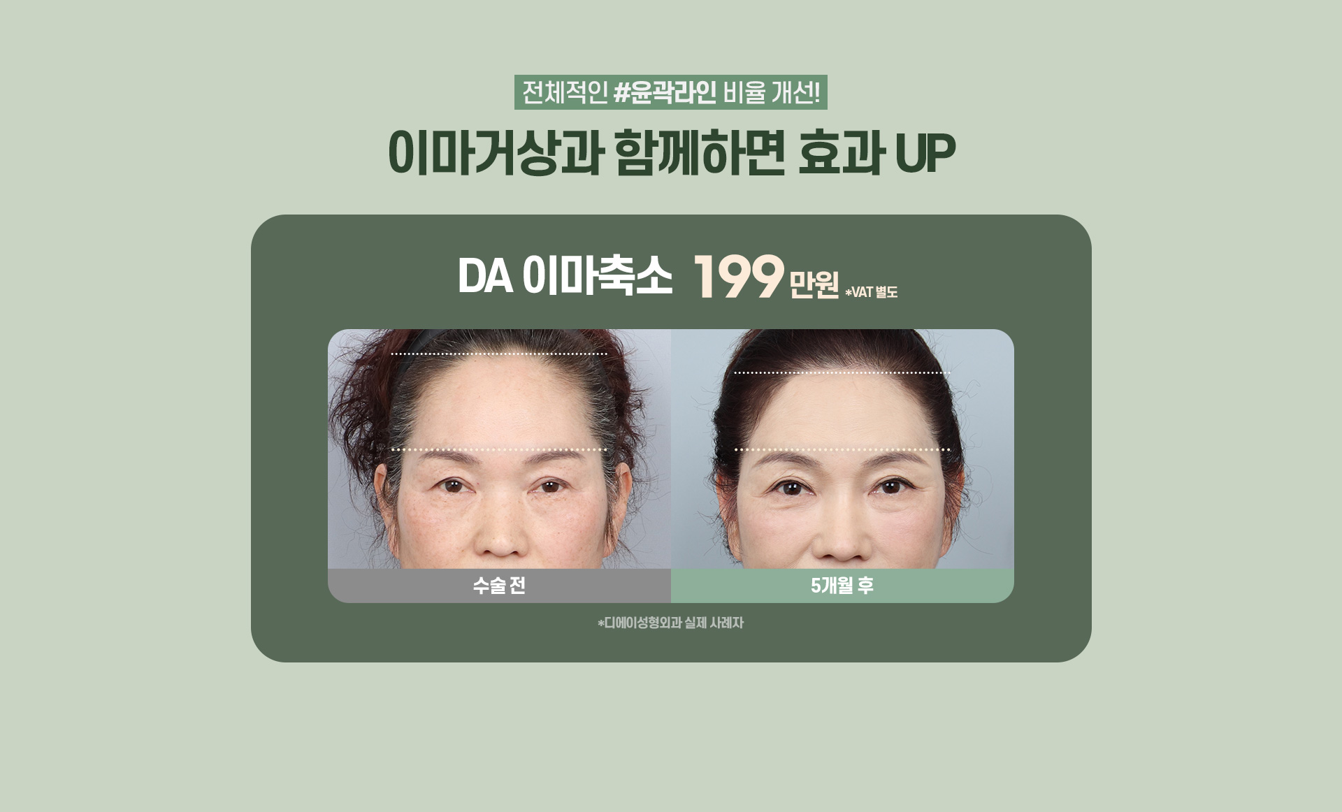 디에이 수직 이마거상