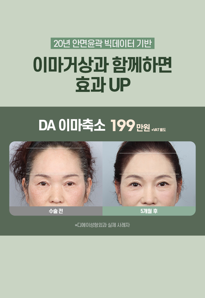 디에이 수직 이마거상