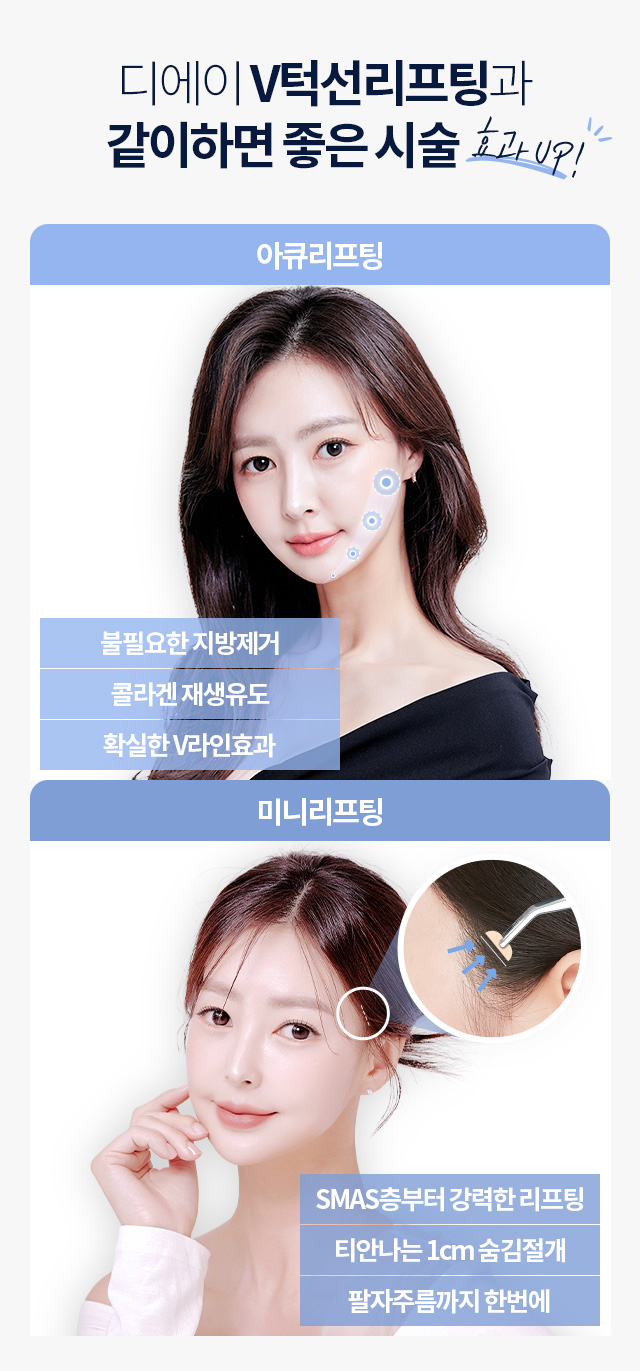 디에이 V턱선리프팅