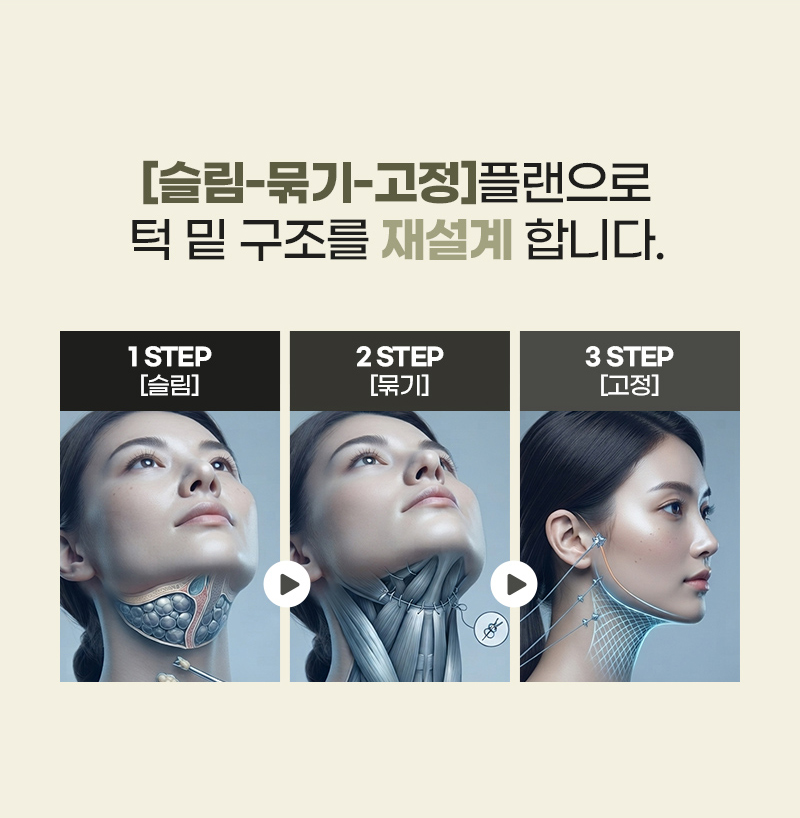디에이 연조직 이중턱 근육묶기