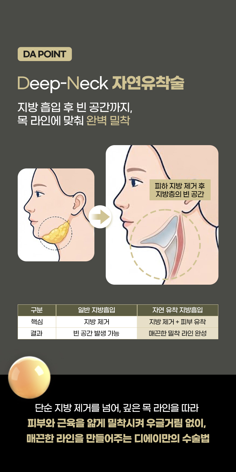 디에이 연조직 이중턱 근육묶기