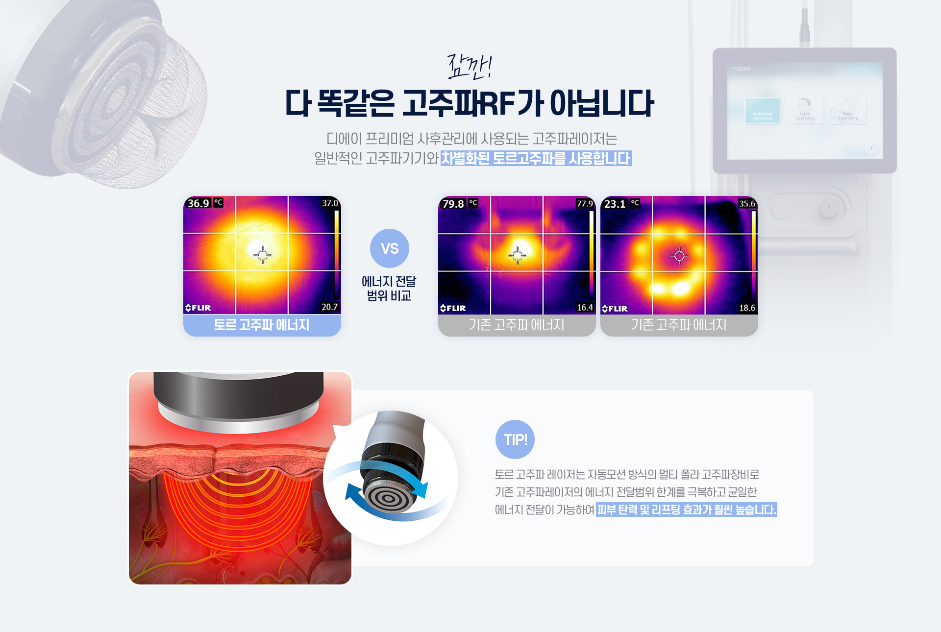 잠깐! 다 똑같은 고주파 RF가 아닙니다.
