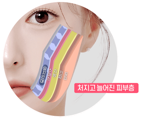 디에이 수직미니리프팅