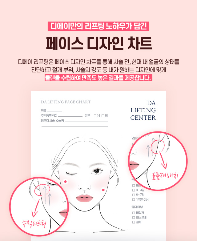 디에이 수직미니리프팅
