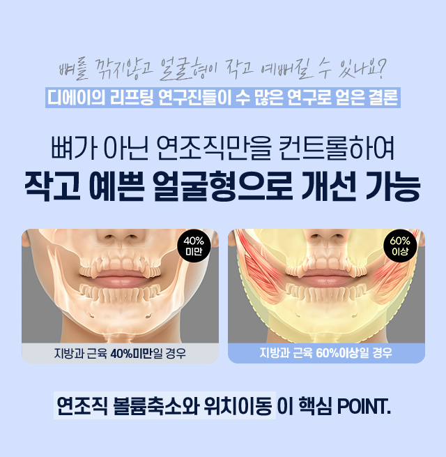 디에이 연조직윤곽술