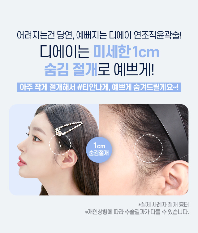 디에이 연조직윤곽술