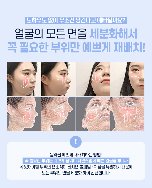 디에이 연조직윤곽술