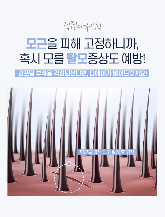 디에이 연조직윤곽술