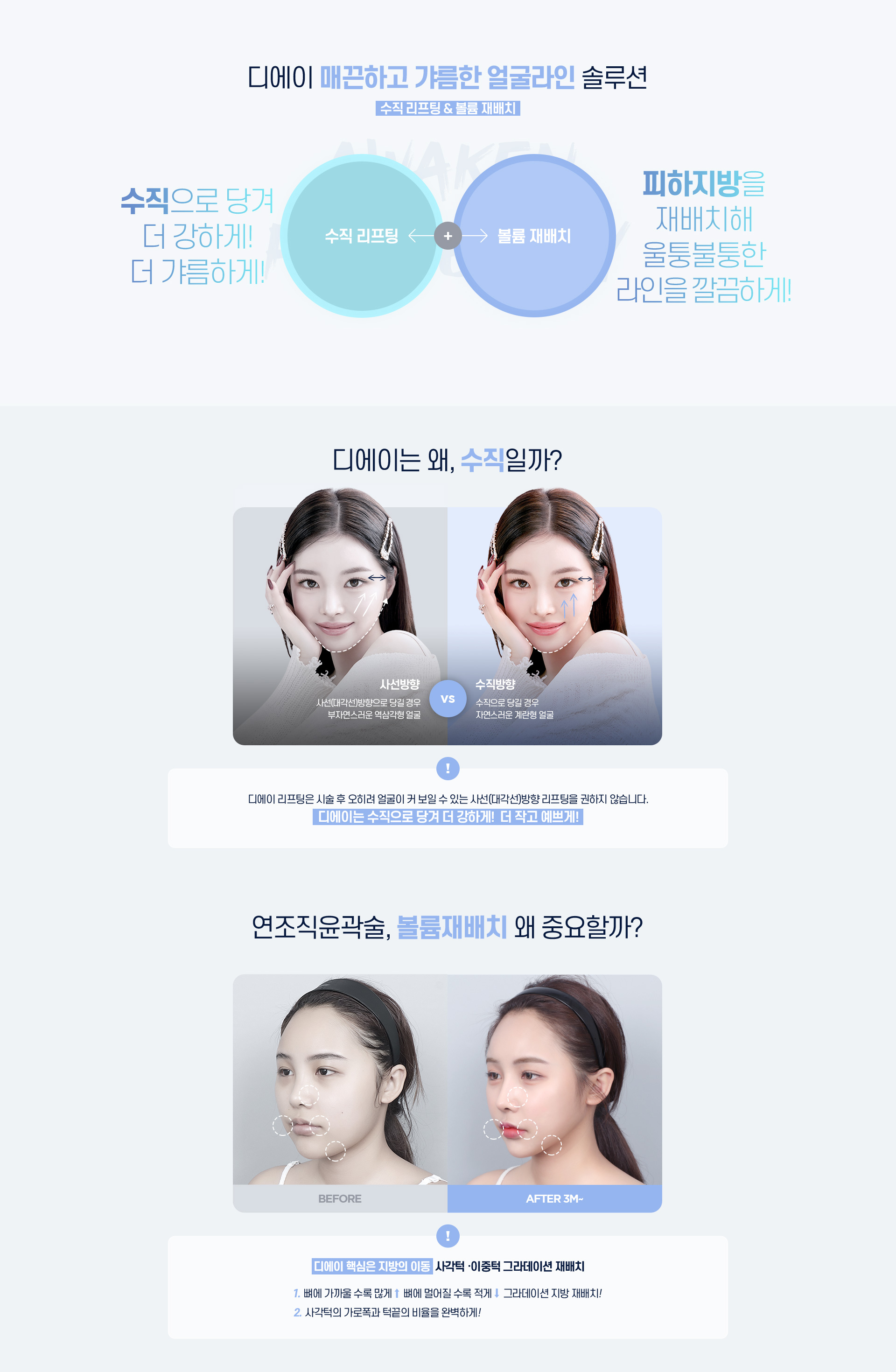 디에이 연조직윤곽술